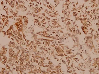 Anti-Dynamin 1 antibody used in IHC (Paraffin sections) (IHC-P). GTX66629