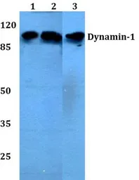 Anti-Dynamin 1 antibody used in Western Blot (WB). GTX66629