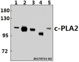 Anti-PLA2G4A antibody used in Western Blot (WB). GTX66631