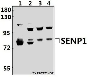 Anti-SENP1 antibody used in Western Blot (WB). GTX66632