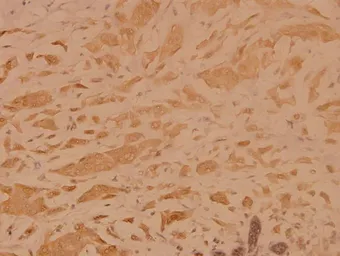 Anti-TRADD antibody used in IHC (Paraffin sections) (IHC-P). GTX66633