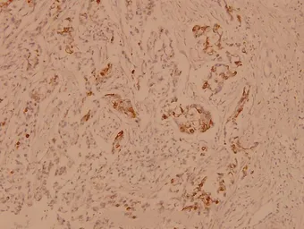 Anti-alpha B Crystallin antibody used in IHC (Paraffin sections) (IHC-P). GTX66638