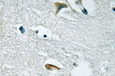 Anti-JAK3 antibody used in IHC (Paraffin sections) (IHC-P). GTX66640