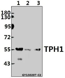 Anti-TPH1 antibody used in Western Blot (WB). GTX66644