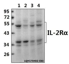 Anti-IL2 Receptor alpha antibody used in Western Blot (WB). GTX66646