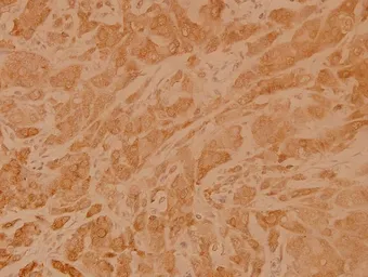 Anti-RhoA antibody used in IHC (Paraffin sections) (IHC-P). GTX66647