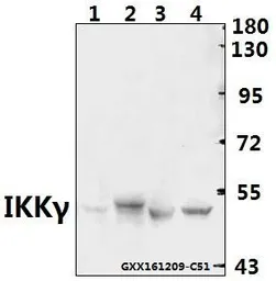 Anti-IKK gamma antibody used in Western Blot (WB). GTX66648