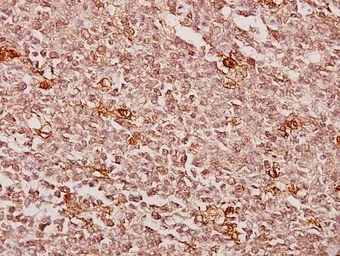 Anti-Creatine kinase (muscle) antibody used in IHC (Paraffin sections) (IHC-P). GTX66650