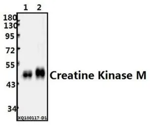 Anti-Creatine kinase (muscle) antibody used in Western Blot (WB). GTX66650
