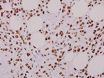 Anti-hnRNP L antibody used in IHC (Paraffin sections) (IHC-P). GTX66652