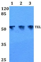 Anti-TEL antibody used in Western Blot (WB). GTX66653