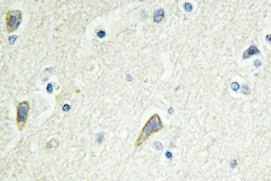 Anti-EphB4 antibody used in IHC (Paraffin sections) (IHC-P). GTX66654