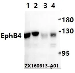Anti-EphB4 antibody used in Western Blot (WB). GTX66654