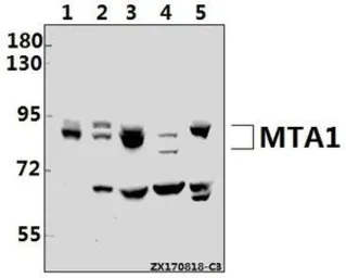 Anti-MTA1 antibody used in Western Blot (WB). GTX66656