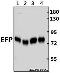 Anti-TRIM25 antibody used in Western Blot (WB). GTX66657