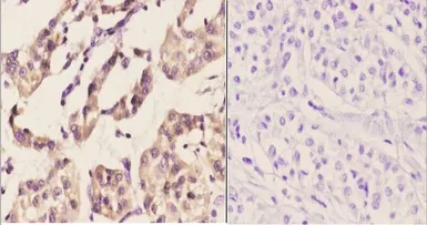Anti-PERK antibody used in IHC (Paraffin sections) (IHC-P). GTX66661