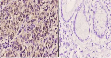 Anti-PERK antibody used in IHC (Paraffin sections) (IHC-P). GTX66661