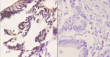 Anti-PERK antibody used in IHC (Paraffin sections) (IHC-P). GTX66661
