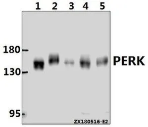 Anti-PERK antibody used in Western Blot (WB). GTX66661