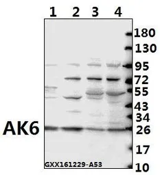 Anti-AK6 antibody used in Western Blot (WB). GTX66662