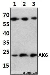 Anti-AK6 antibody used in Western Blot (WB). GTX66662