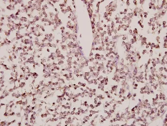 Anti-CYP24A1 antibody used in IHC (Paraffin sections) (IHC-P). GTX66663