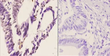 Anti-CDC37 antibody used in IHC (Paraffin sections) (IHC-P). GTX66664