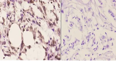 Anti-CDC37 antibody used in IHC (Paraffin sections) (IHC-P). GTX66664