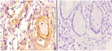 Anti-Maspin antibody used in IHC (Paraffin sections) (IHC-P). GTX66666