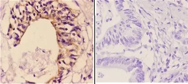 Anti-Maspin antibody used in IHC (Paraffin sections) (IHC-P). GTX66666