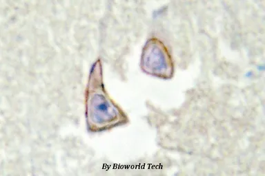 Anti-KSR2 antibody used in IHC (Paraffin sections) (IHC-P). GTX66673