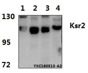 Anti-KSR2 antibody used in Western Blot (WB). GTX66673