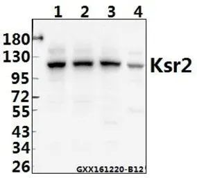 Anti-KSR2 antibody used in Western Blot (WB). GTX66673
