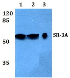 Anti-5-HT3A receptor antibody used in Western Blot (WB). GTX66674