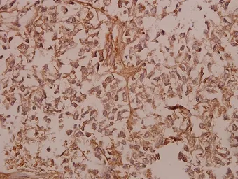 Anti-COL5A1 antibody used in IHC (Paraffin sections) (IHC-P). GTX66675