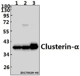 Anti-Clusterin alpha antibody used in Western Blot (WB). GTX66676