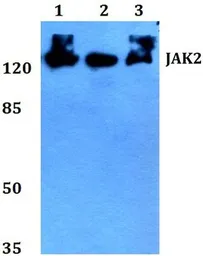 Anti-JAK2 antibody used in Western Blot (WB). GTX66678