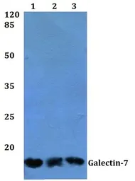 Anti-Galectin 7 antibody used in Western Blot (WB). GTX66682