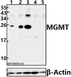 Anti-MGMT antibody used in Western Blot (WB). GTX66683