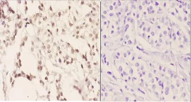 Anti-SFRS3 antibody used in IHC (Paraffin sections) (IHC-P). GTX66685