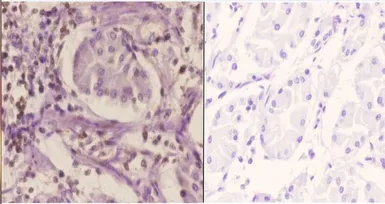 Anti-SFRS3 antibody used in IHC (Paraffin sections) (IHC-P). GTX66685