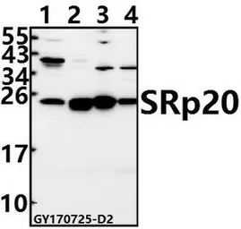 Anti-SFRS3 antibody used in Western Blot (WB). GTX66685