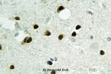 Anti-Histone H2B antibody used in IHC (Paraffin sections) (IHC-P). GTX66686