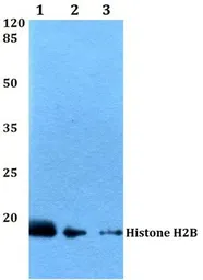 Anti-Histone H2B antibody used in Western Blot (WB). GTX66686