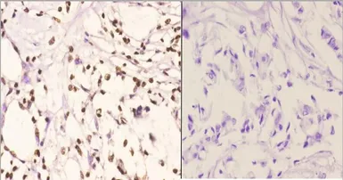 Anti-PU.1 antibody used in IHC (Paraffin sections) (IHC-P). GTX66691