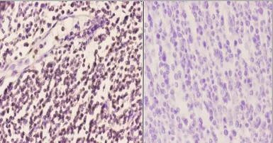 Anti-PU.1 antibody used in IHC (Paraffin sections) (IHC-P). GTX66691