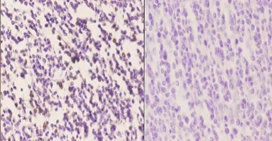 Anti-IRF4 / MUM1 antibody used in IHC (Paraffin sections) (IHC-P). GTX66692