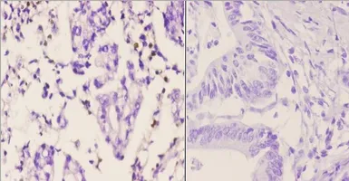 Anti-PMS2 antibody used in IHC (Paraffin sections) (IHC-P). GTX66694