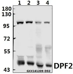 Anti-PMS2 antibody used in Western Blot (WB). GTX66694