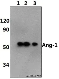 Anti-Angiopoietin 1 antibody used in Western Blot (WB). GTX66700